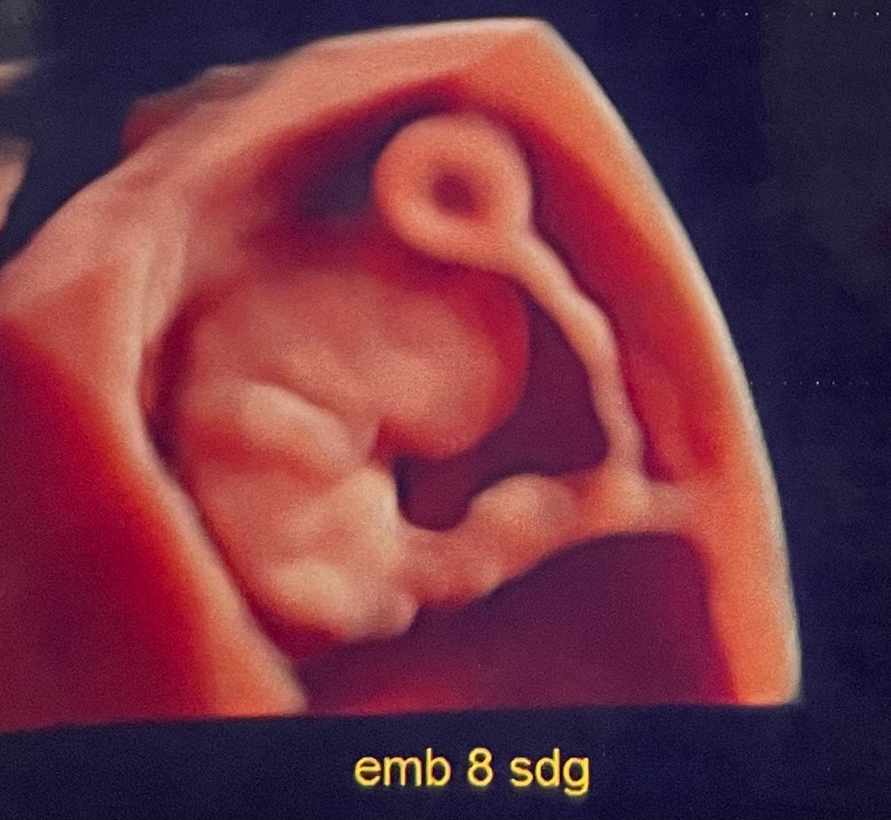 Mayi Mayret Mesquiti-20