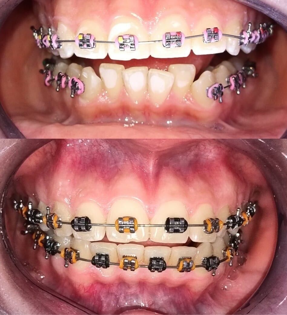 Luz Anel Valente Lozano-13