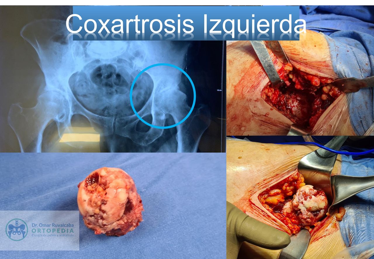 Omar Ruvalcaba Luna-20