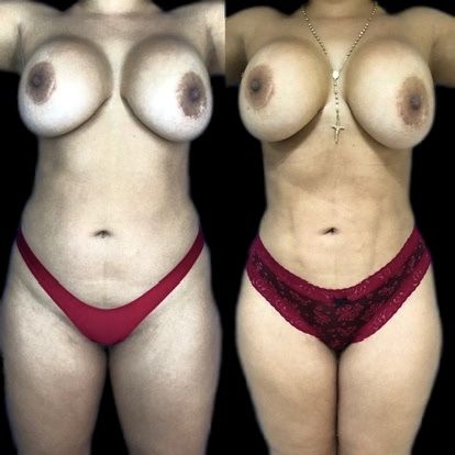 Luis Atilio Gil Pérez-13