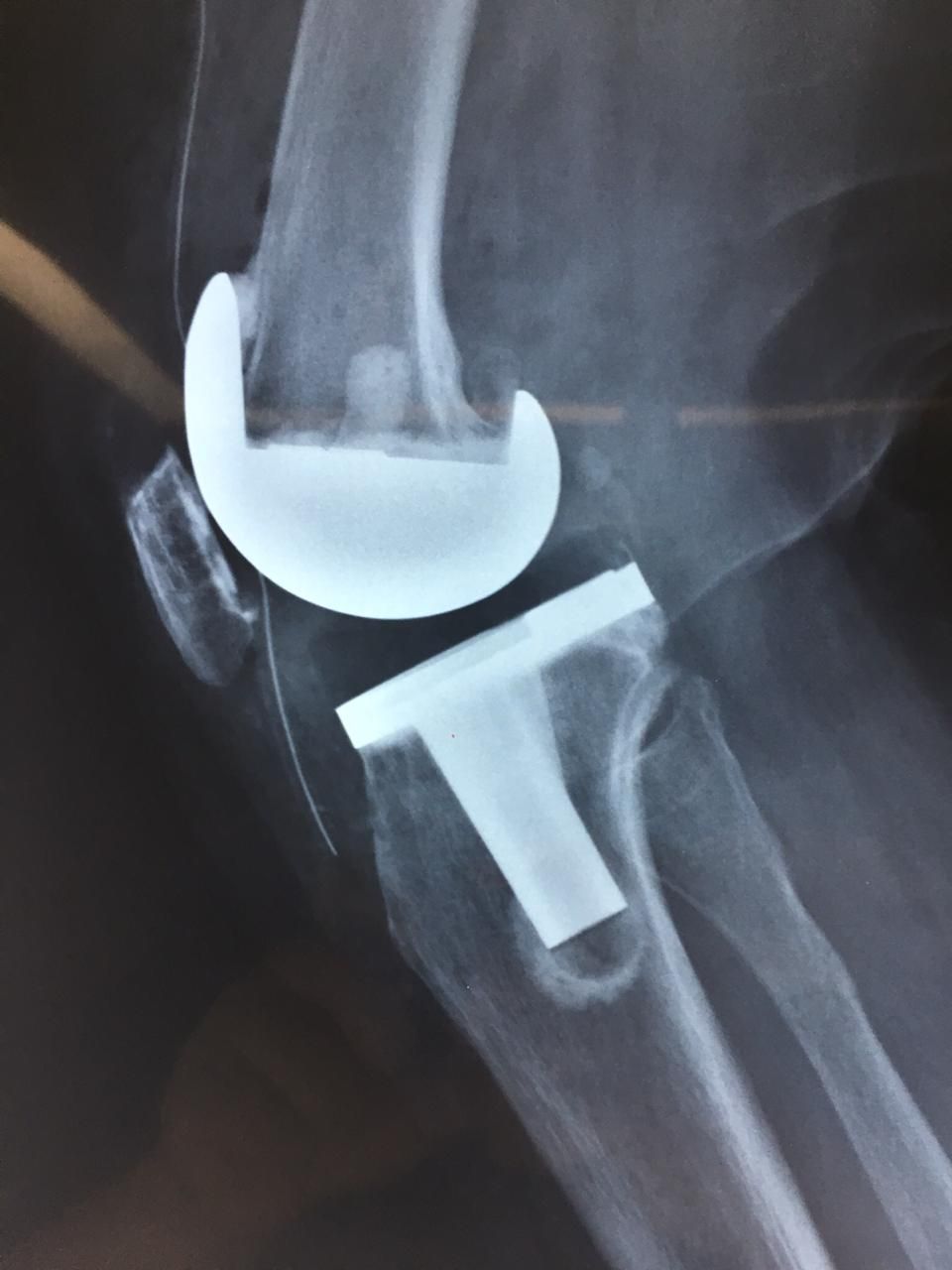 Neftali Lagos Mariscal-3