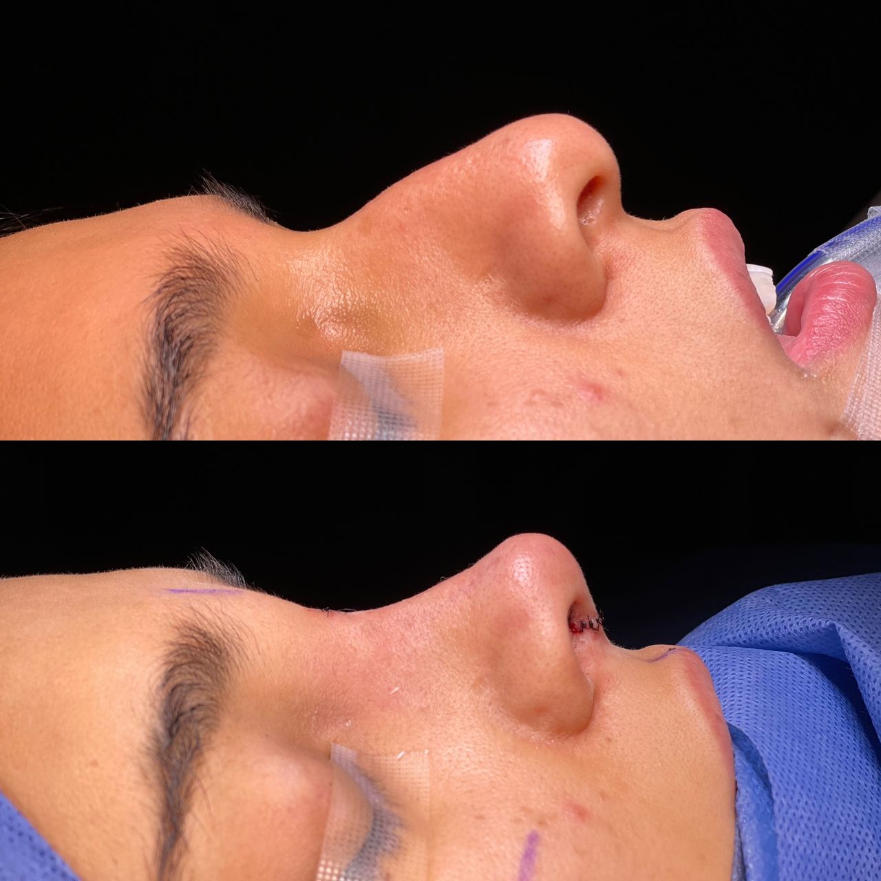 Angel Castro Urquizo-188