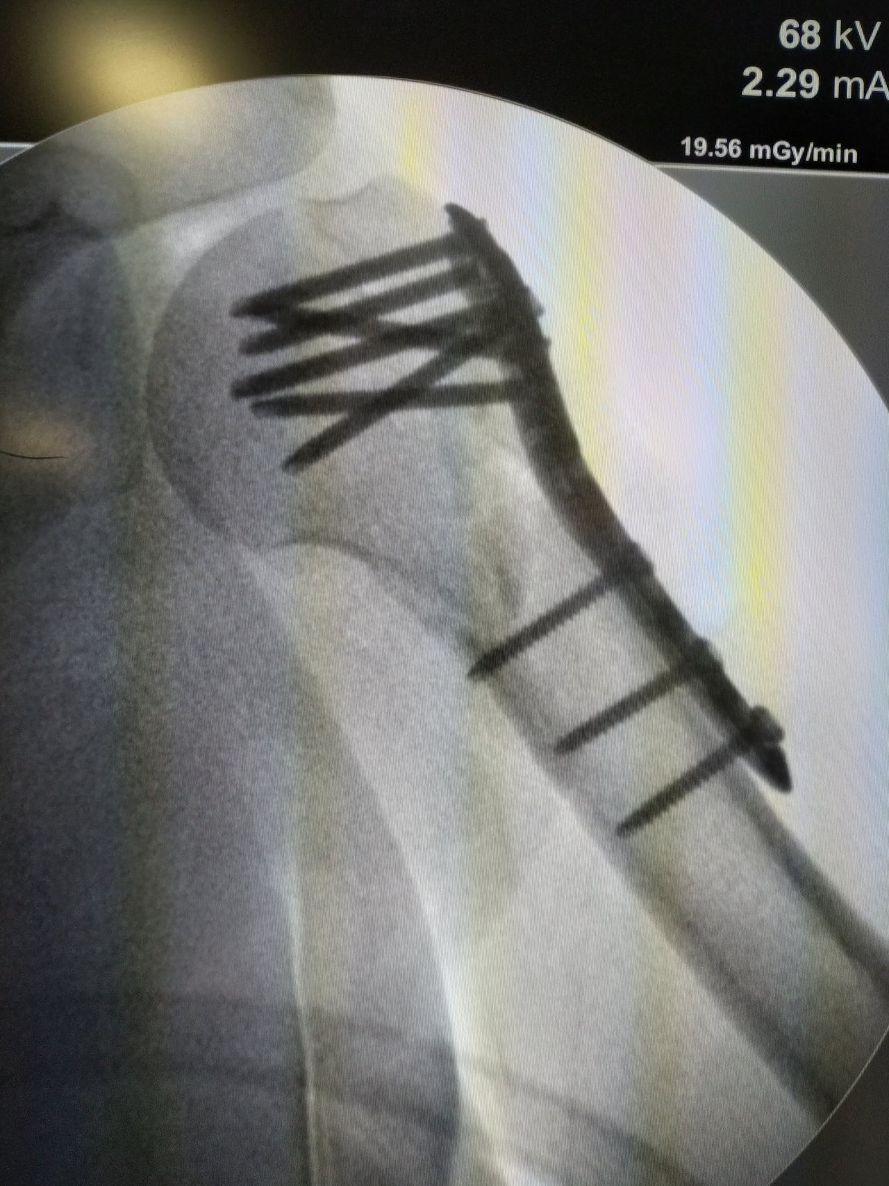 Simón Almanza Mendoza-2