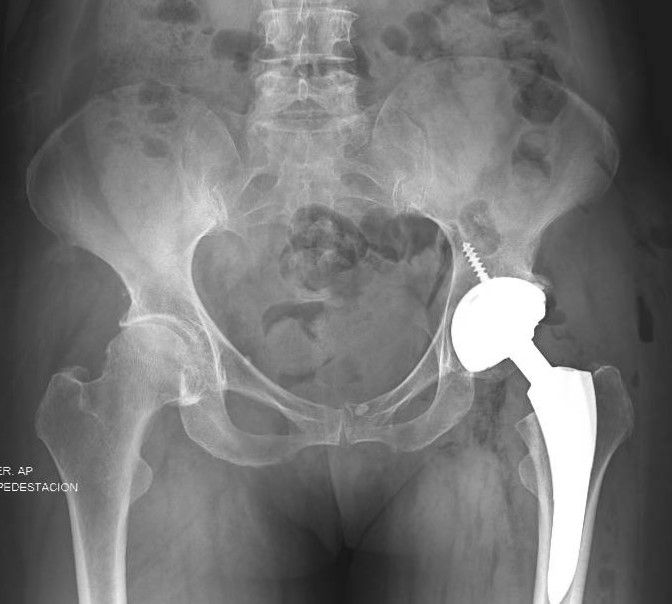 Zamir Alejandro Zárate Ayup-1