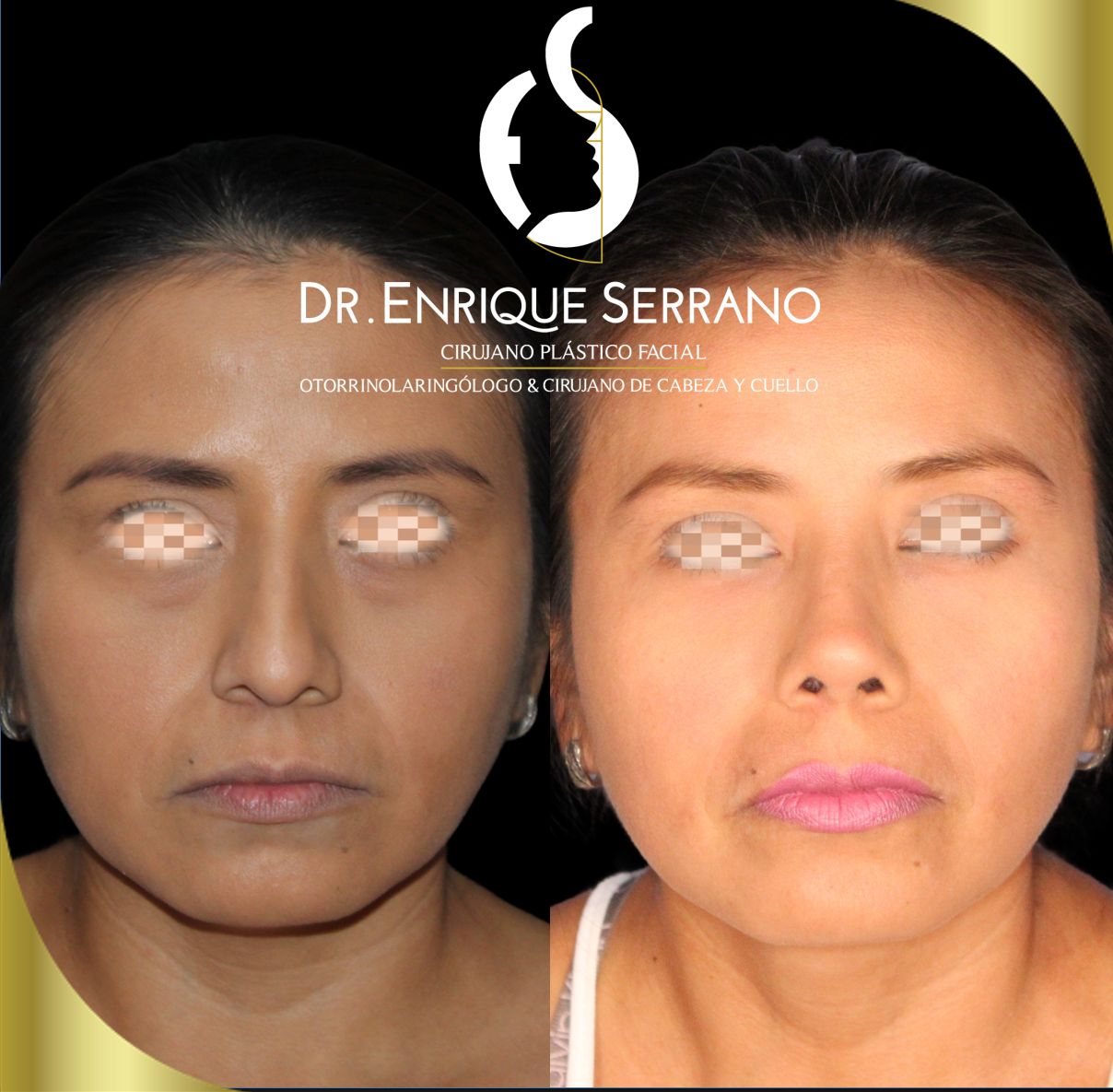 Enrique Serrano Cruz-7