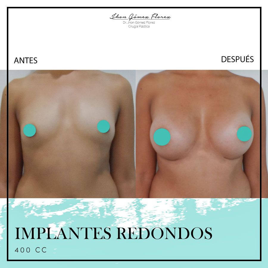 Jhon César Gómez Florez-44