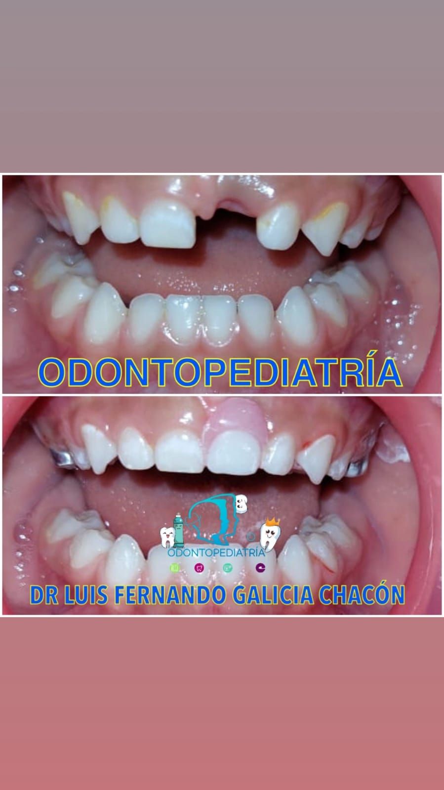 Luis Fernando Galicia Chacón-29