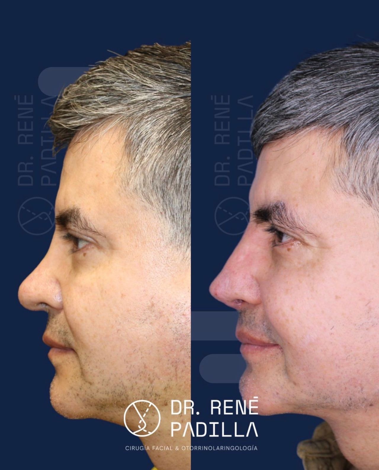 René Emmanuel Padilla López-28