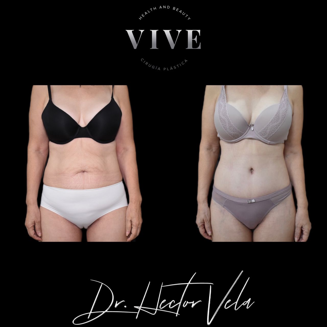 Héctor Eduardo Vela Cardona-114