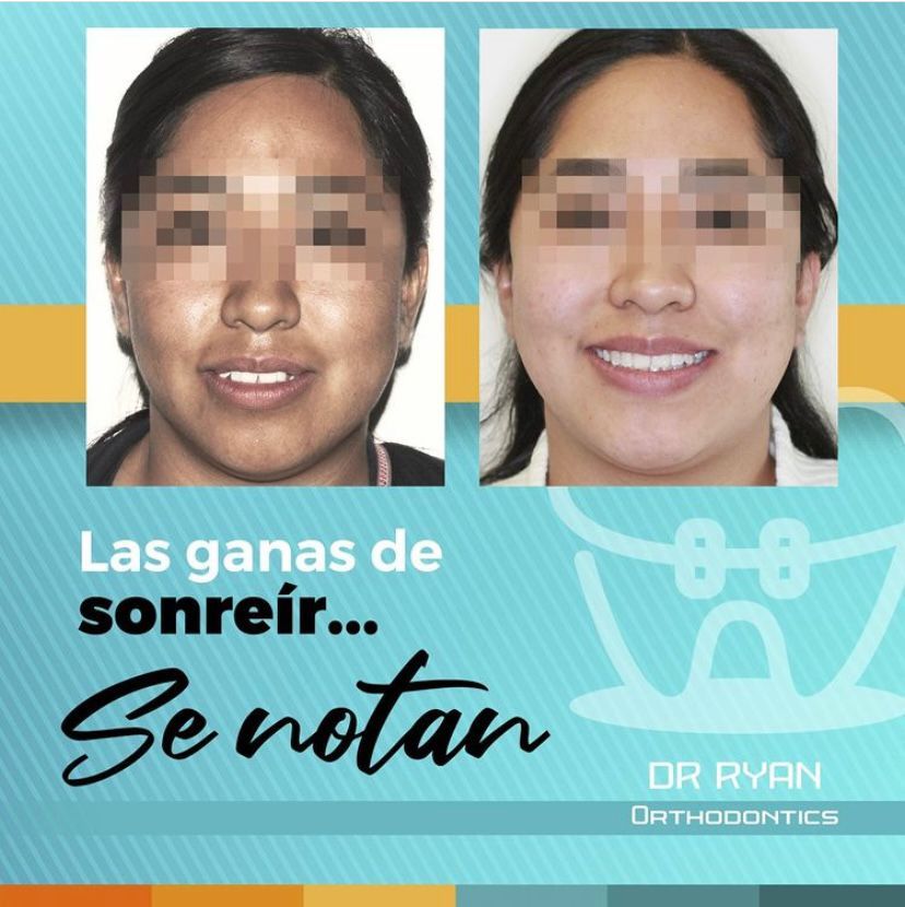 Ryan Michael Brenes Pacheco-7