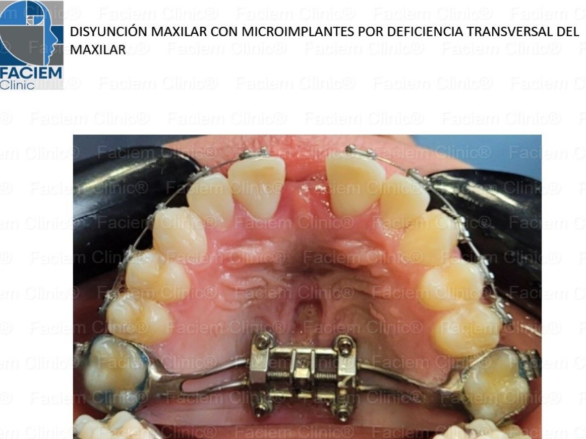 Arlen Colín Ordaz-16