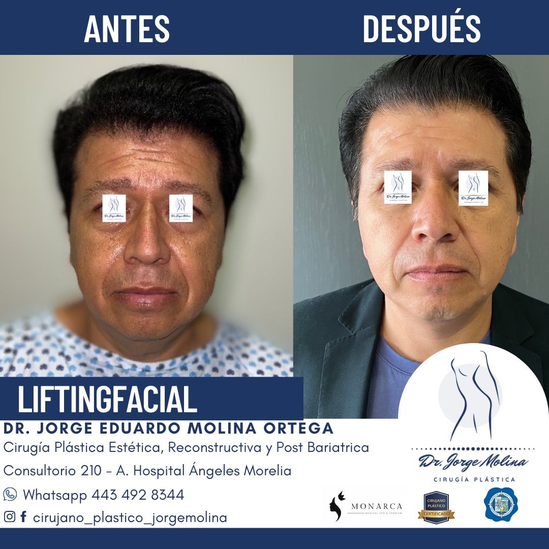 Jorge Eduardo Molina Ortega-15