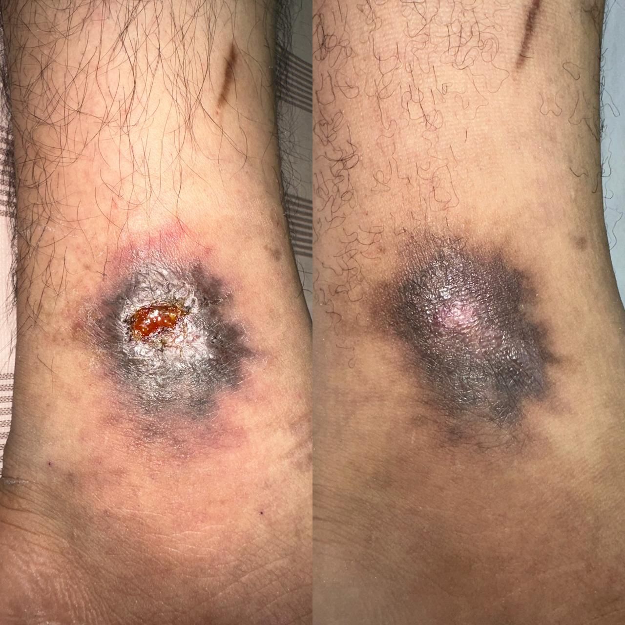 Jhonatan López González-27