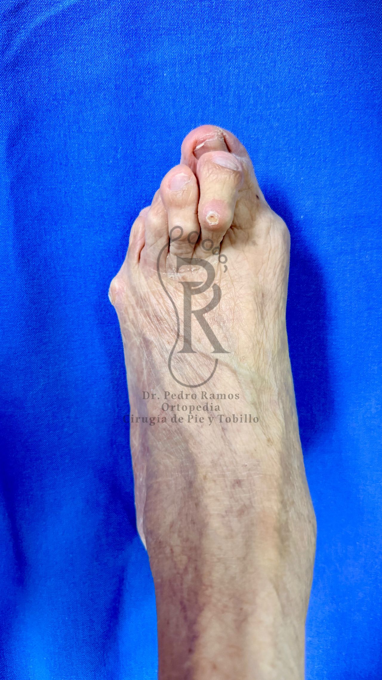 Pedro Ramos Jurado-4