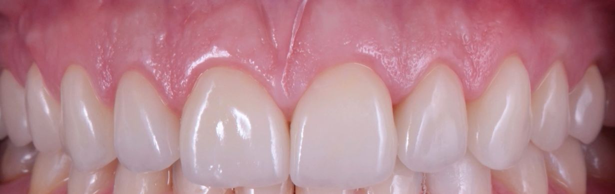 Erika Díaz De León Torres-10