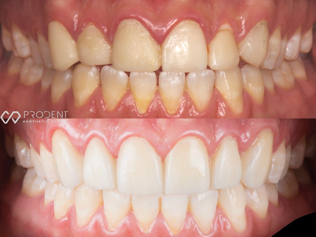 Ulises Pérez Murillo-48