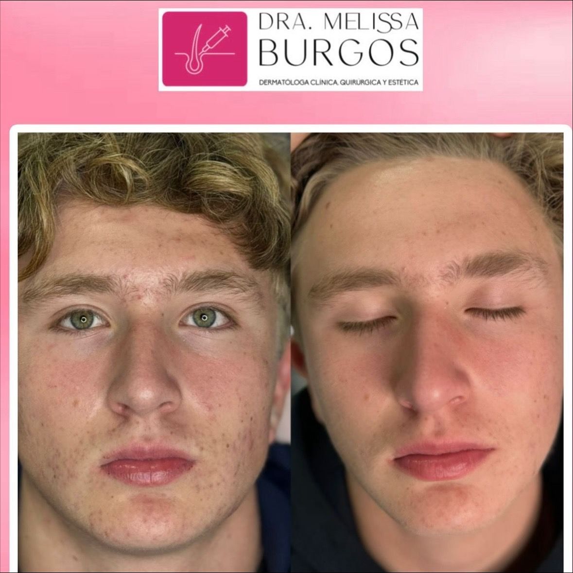 Melissa Burgos Romero-4