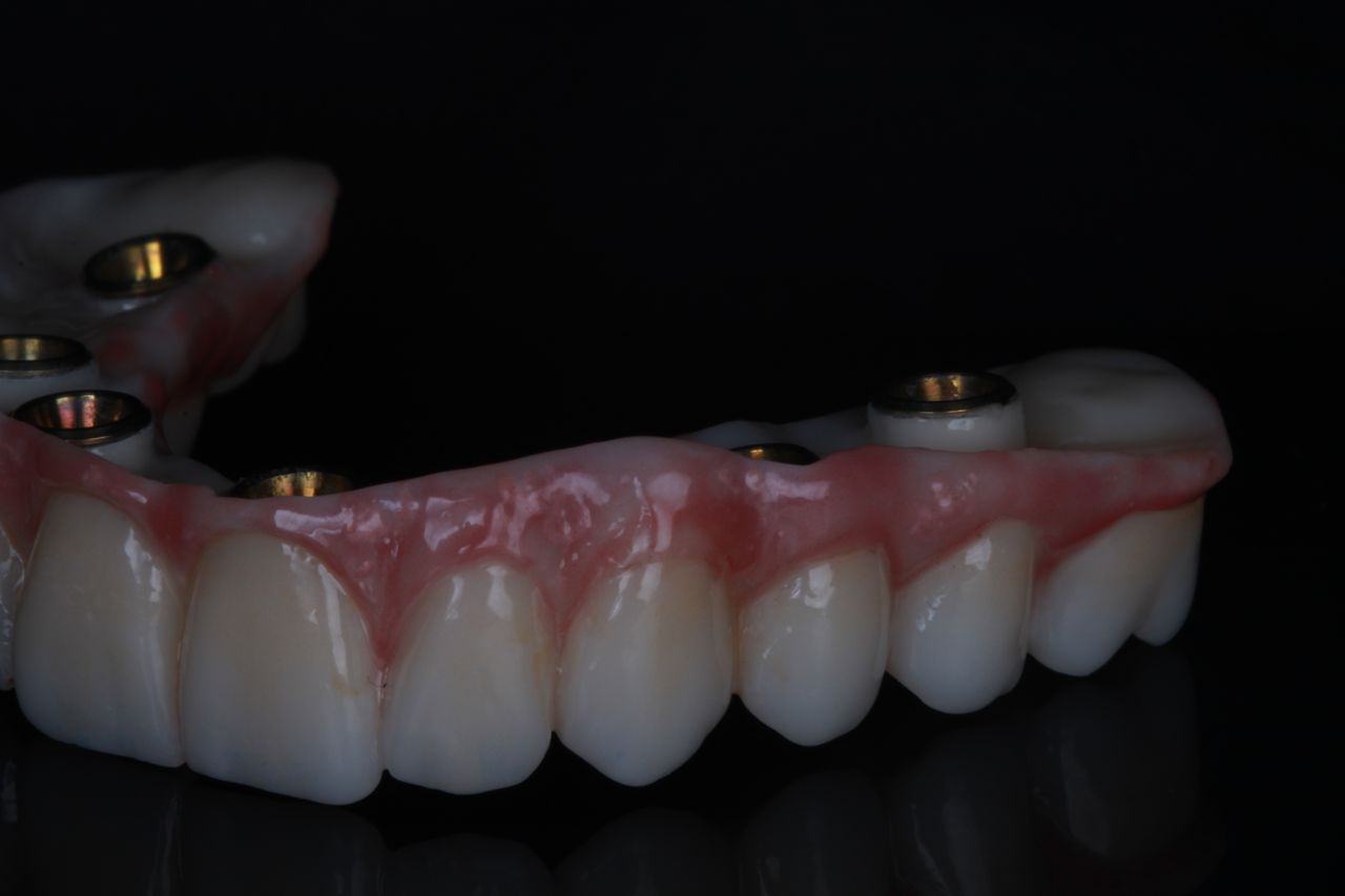 Diana Chacon Cervera-9