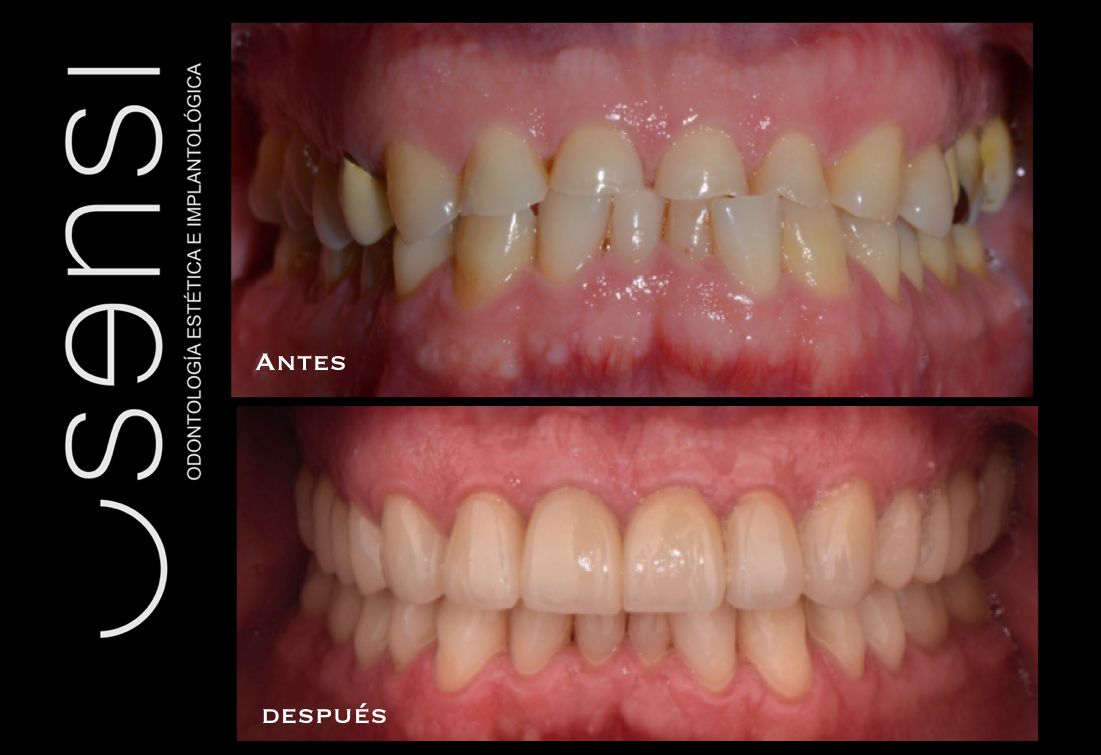 Luis Olvera Hernández-7