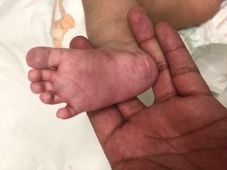 Joel Barroso Santos-29