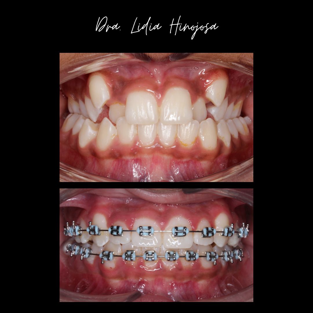 Lidia Abigail Hinojosa Arellanes-29