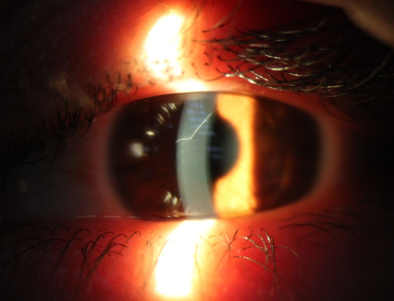 Kalid Barush Hernández Diaz-5