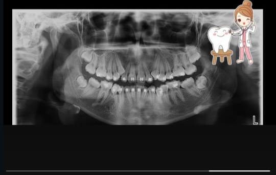 Leslie Michelle Galan Bahena-25