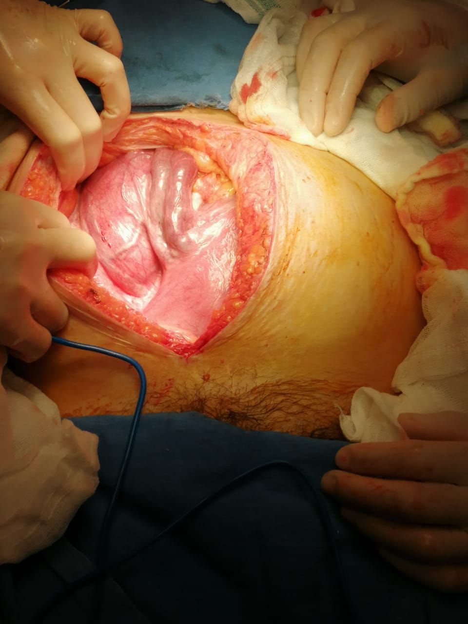 Brenda Anaid Torres Ugalde-19