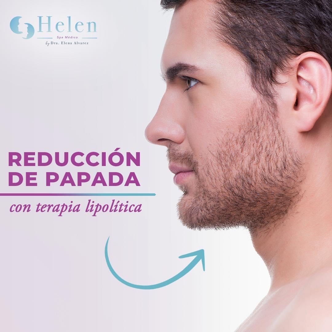 Elena Alvarez Velazquez-32