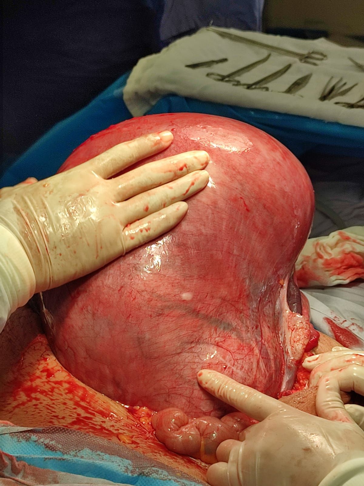 Gonzalo Hernández Martínez-32