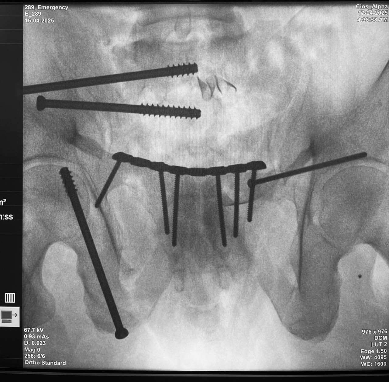 Zamir Alejandro Zárate Ayup-0