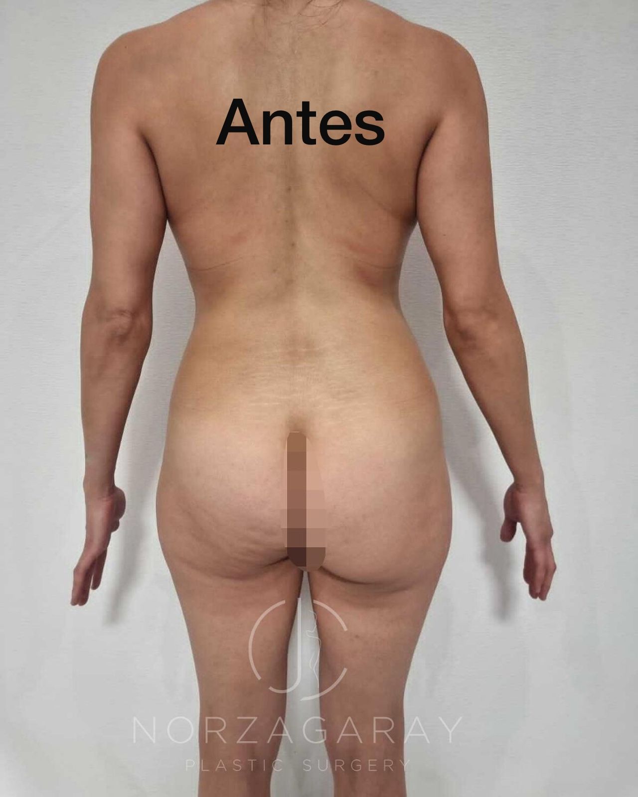 Juan Carlos Norzagaray-23