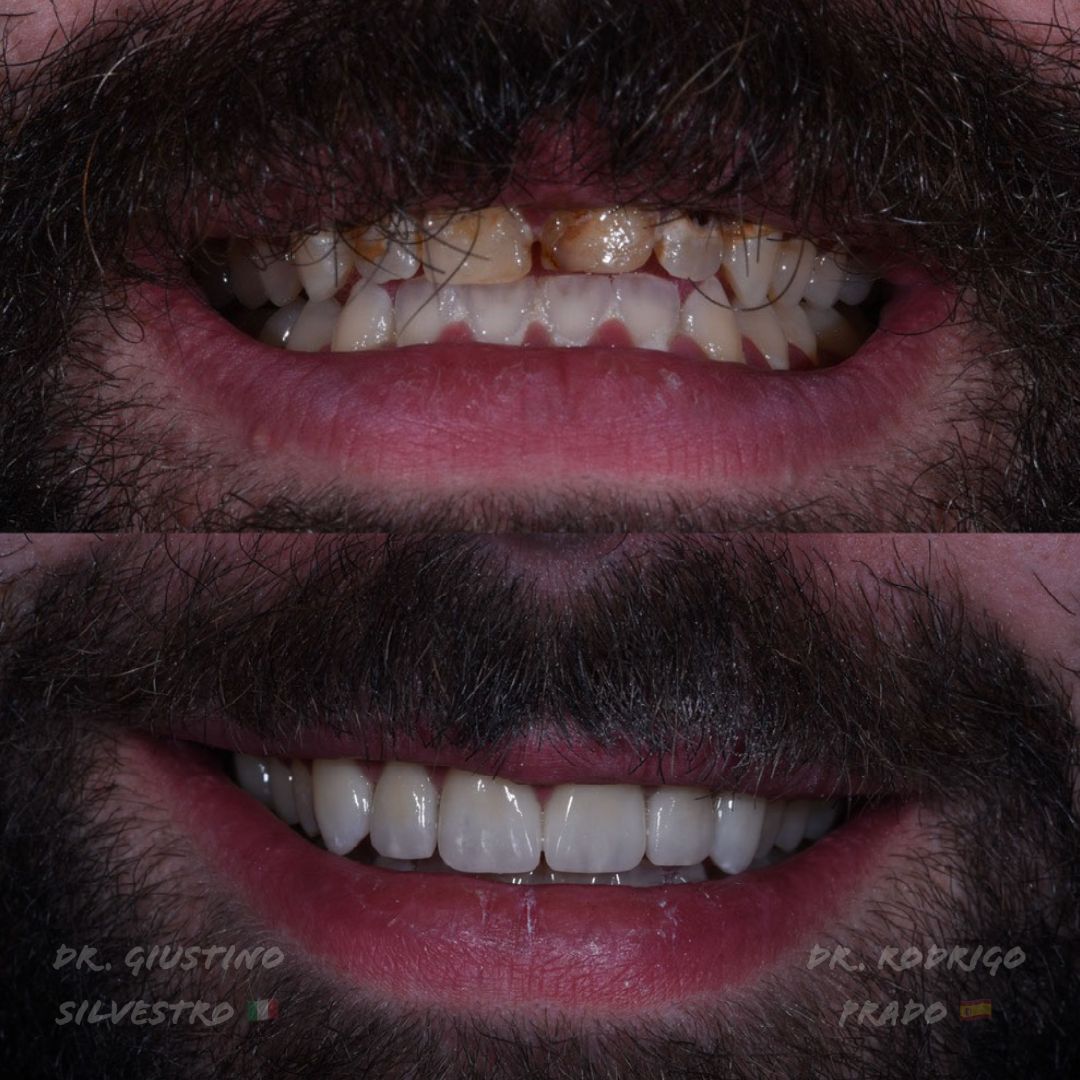 Giustino Silvestro-1