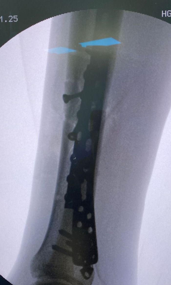 Leonardo Isaac Re-22