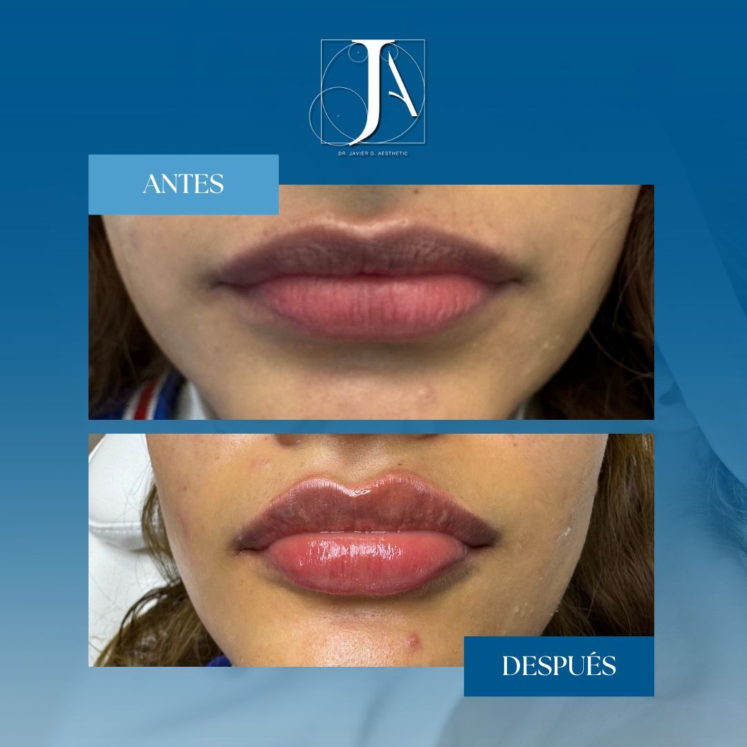 Javier Aztegui Galindo-2