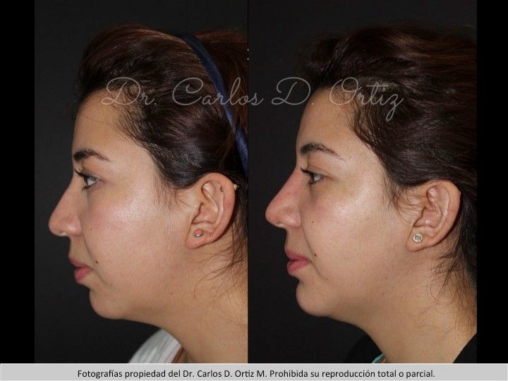 Carlos David Ortiz Moreno-63