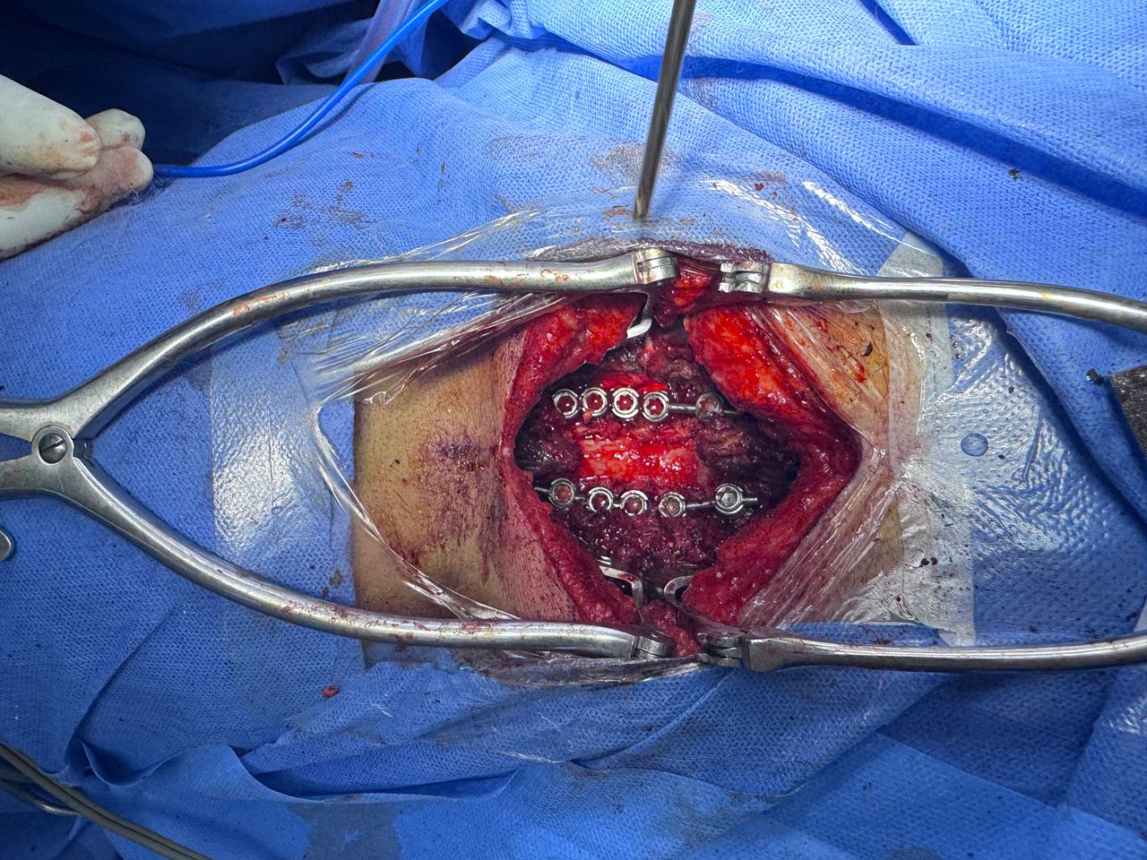 Samuel Carlos Herrera Avila-7