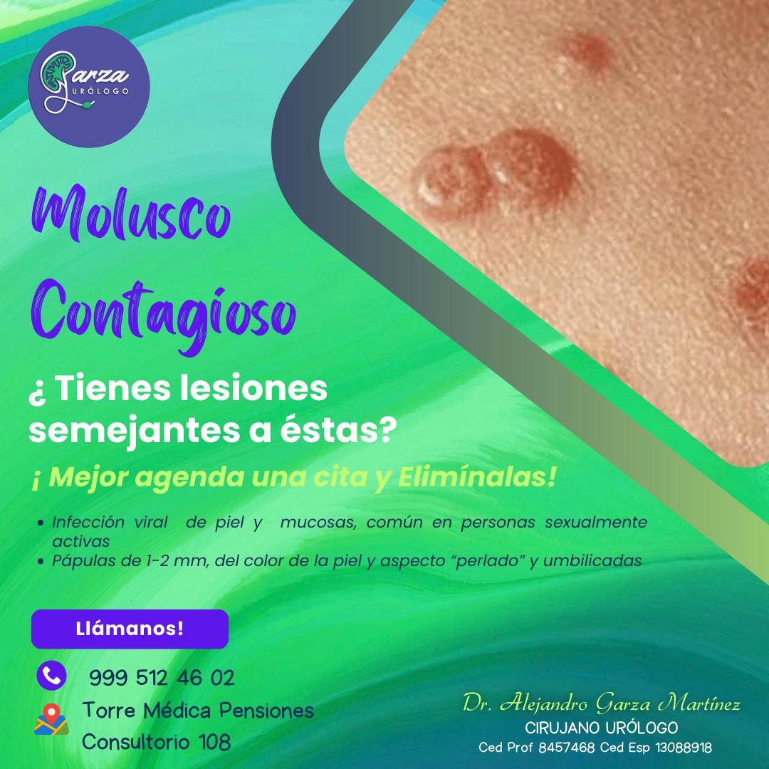 Alejandro Garza Martinez-9