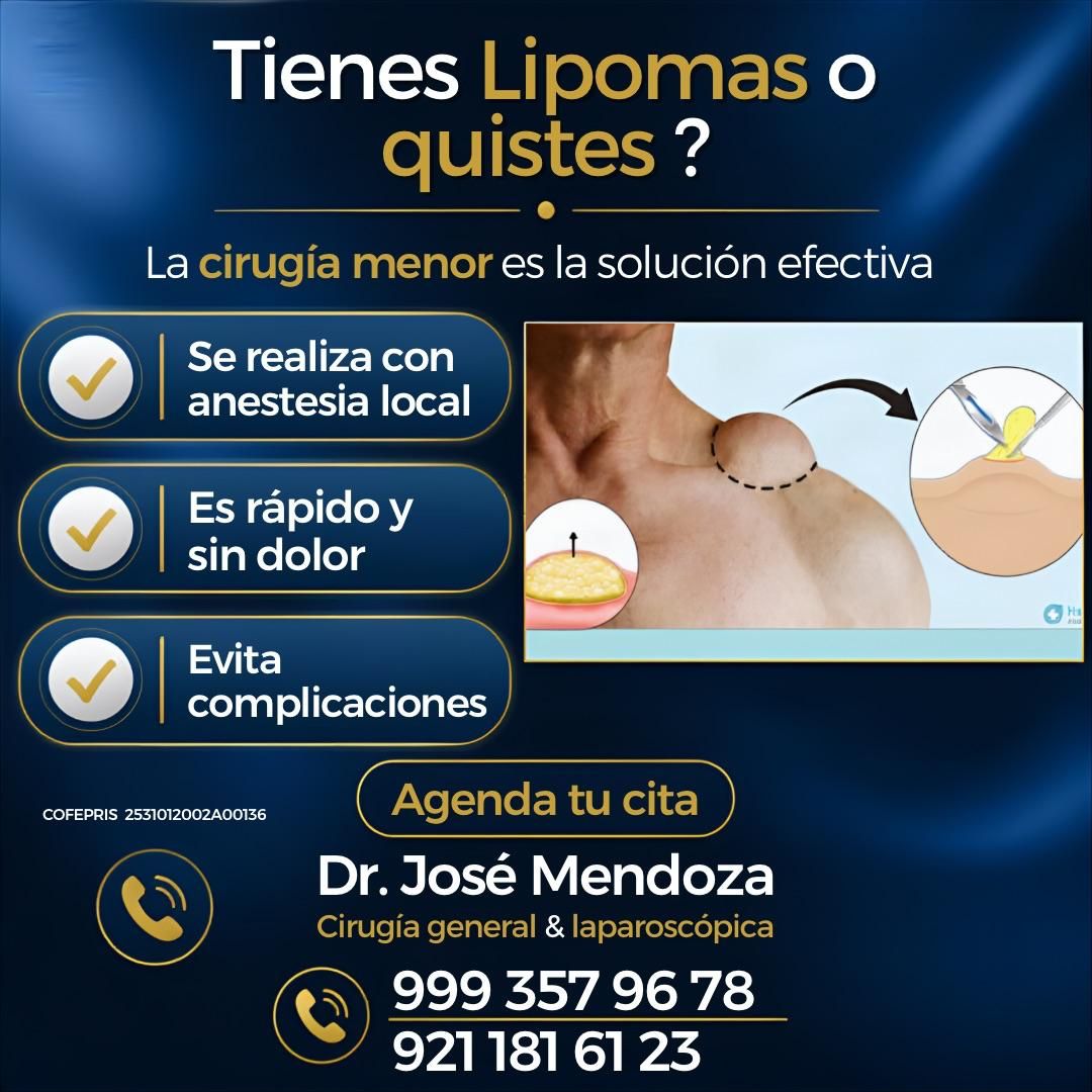 José De Jesus Mendoza Palomec-28