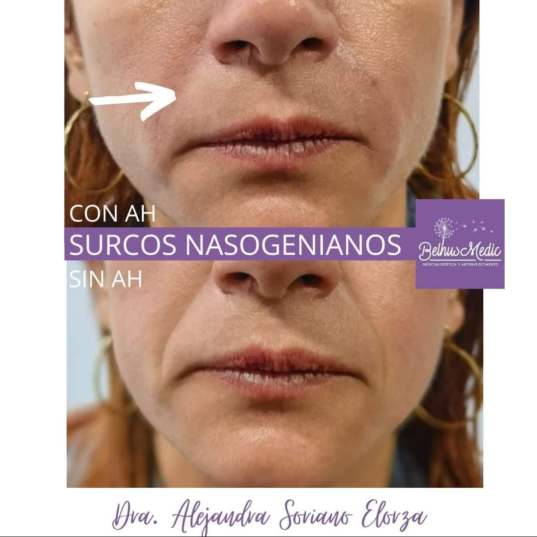 Alejandra Soriano Elorza-41