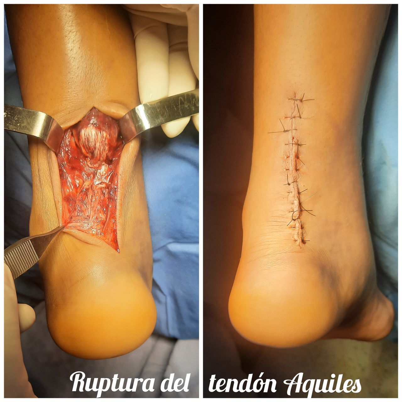 Otilia Gallegos De La Torre-4