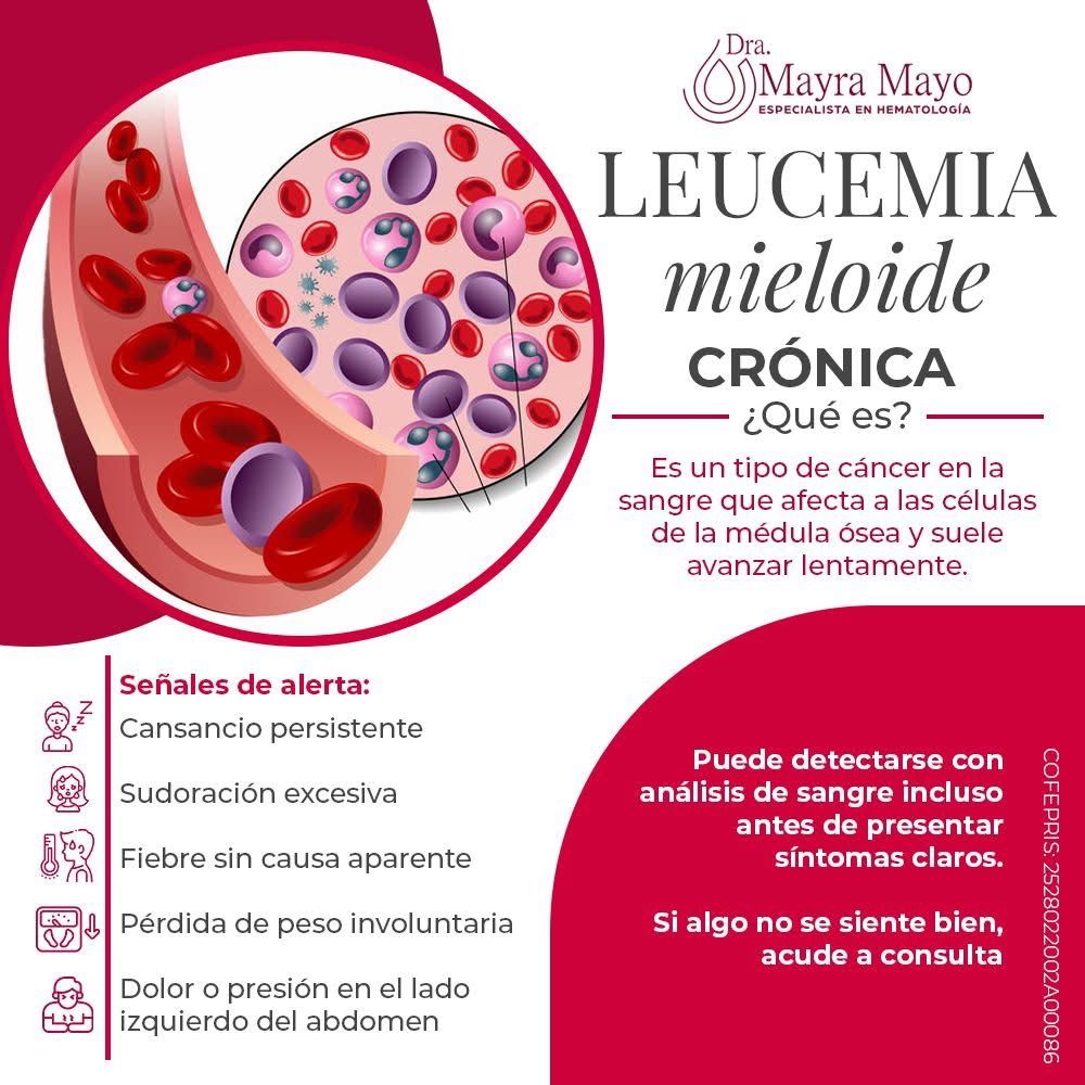 Mayra Lizbeth Mayo Martinez-11