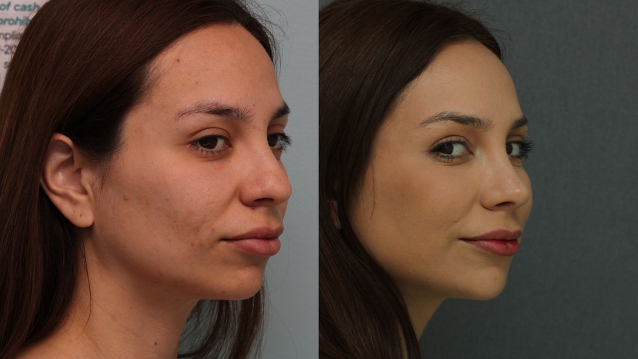 Angel Castro Urquizo-75