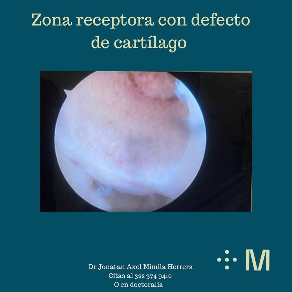 Jonatan Axel Mimila Herrera-15