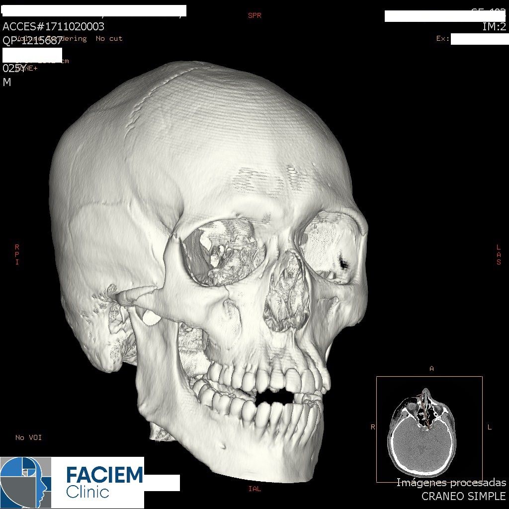 Arlen Colín Ordaz-34