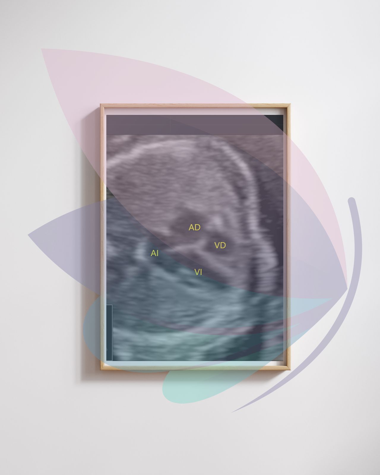 Edgar Zárate Xochimatzi-15