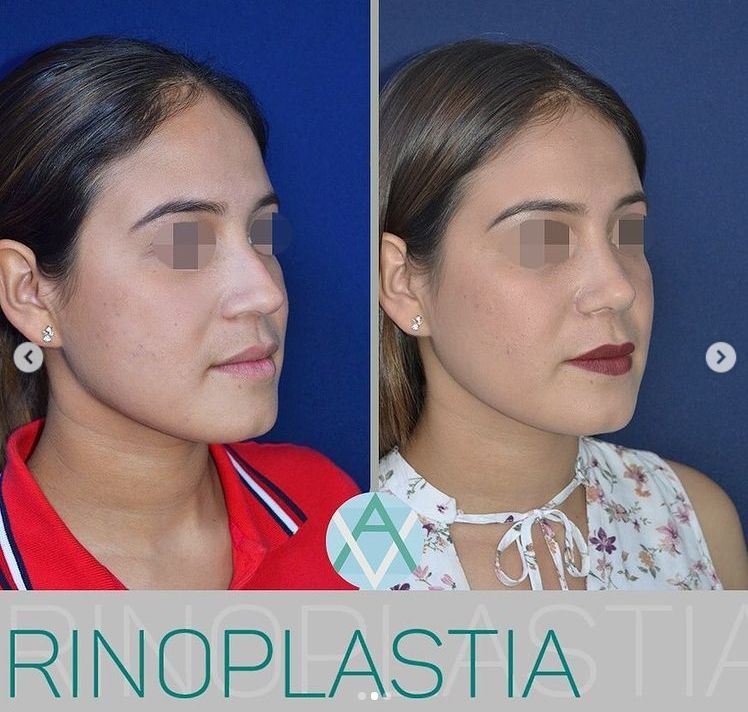 Alfonso Villaseñor Herrero-11