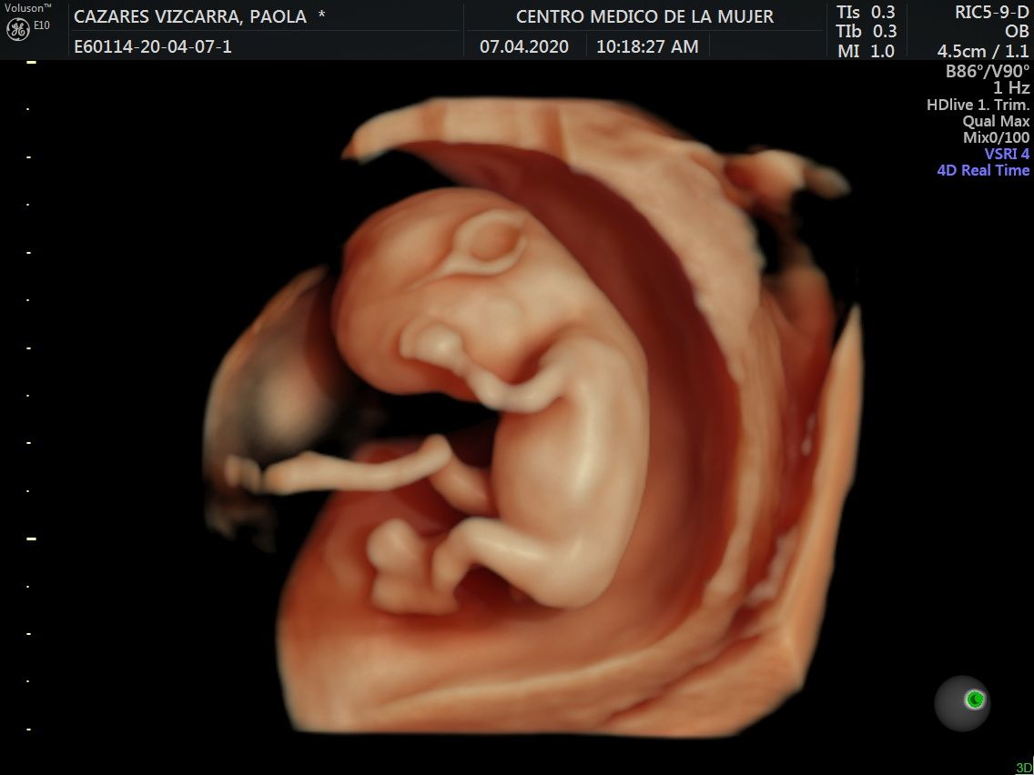 Julio Cesar Monárrez Martín-25