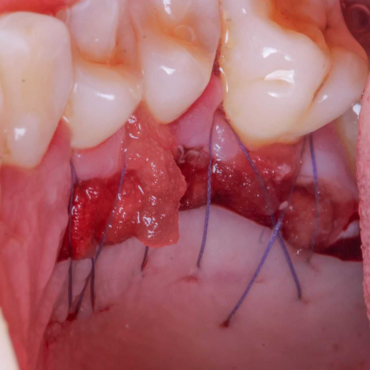 Hugo Enrique Aguilar Lamas-38