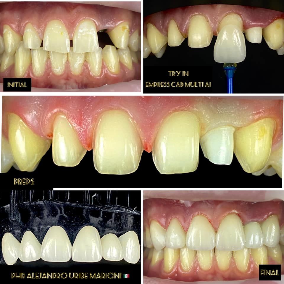 Alejandro Uribe Marioni-2